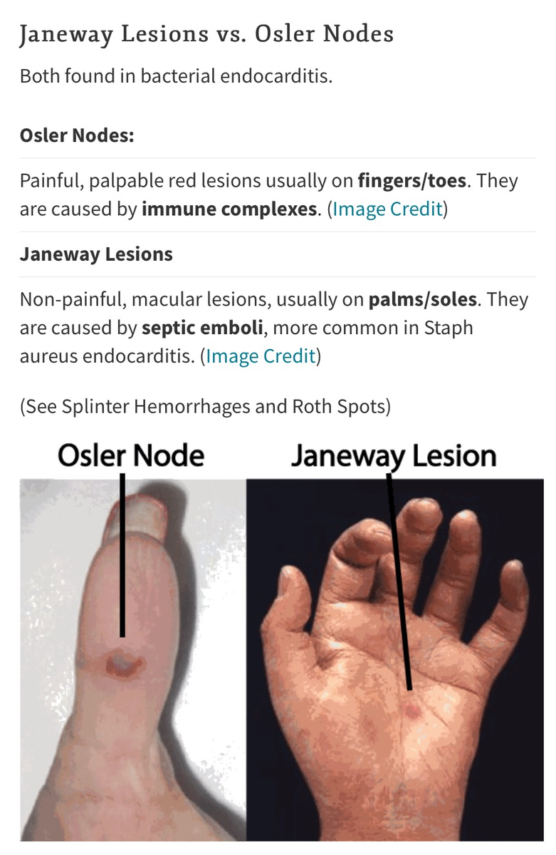 f:id:ararepyon:20191011092213p:plain f:id:ararepyon:20191011092213p:plain