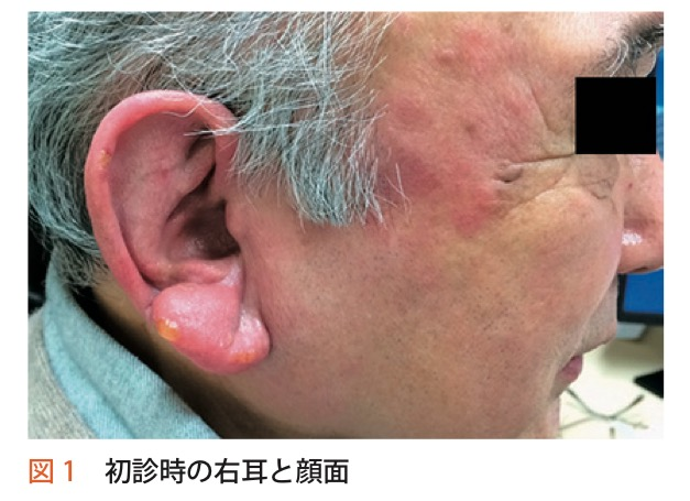 f:id:ararepyon:20191110100558p:plain f:id:ararepyon:20191110100558p:plain