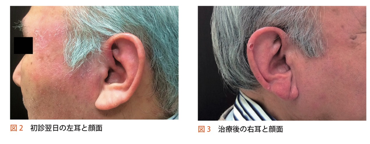 f:id:ararepyon:20191110100614p:plain f:id:ararepyon:20191110100614p:plain