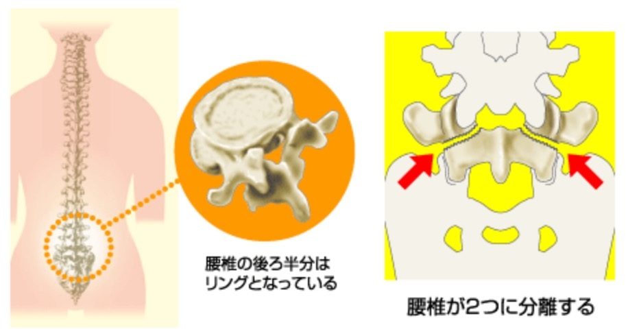 f:id:ararepyon:20191112124544p:plain f:id:ararepyon:20191112124544p:plain