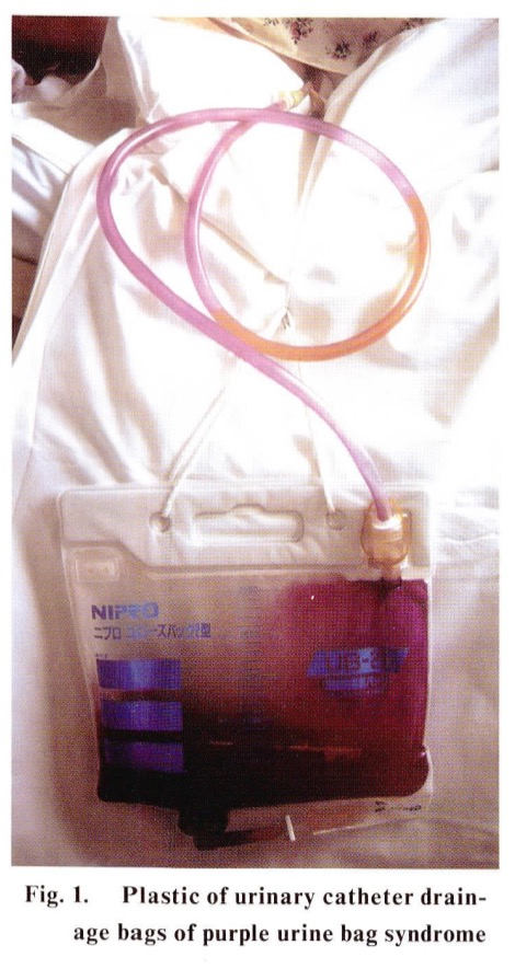 f:id:ararepyon:20191212103809p:plain