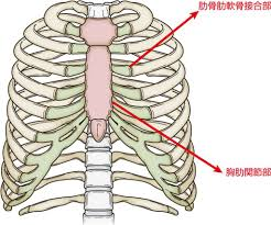 医師は肋軟骨炎をどのように診断しますか?