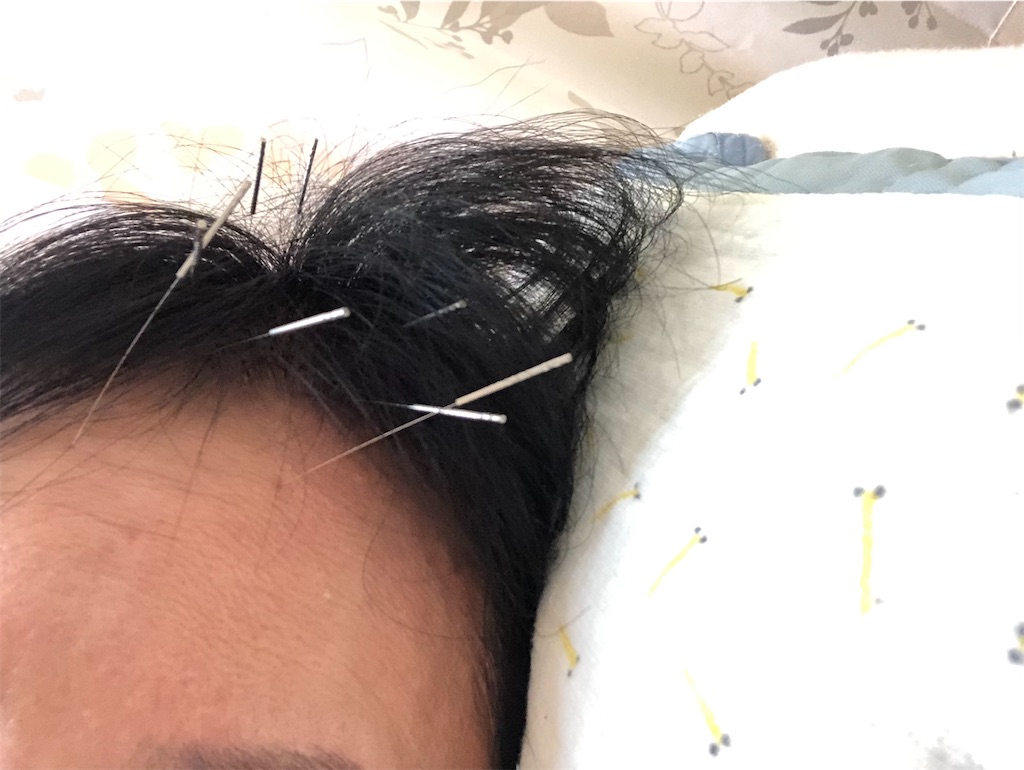 f:id:arcadia1017:20220103194831j:image