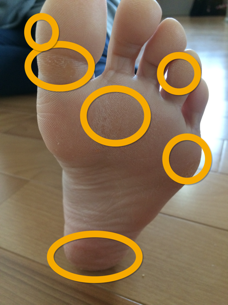 f:id:arch-emiasu:20180204162345p:plain