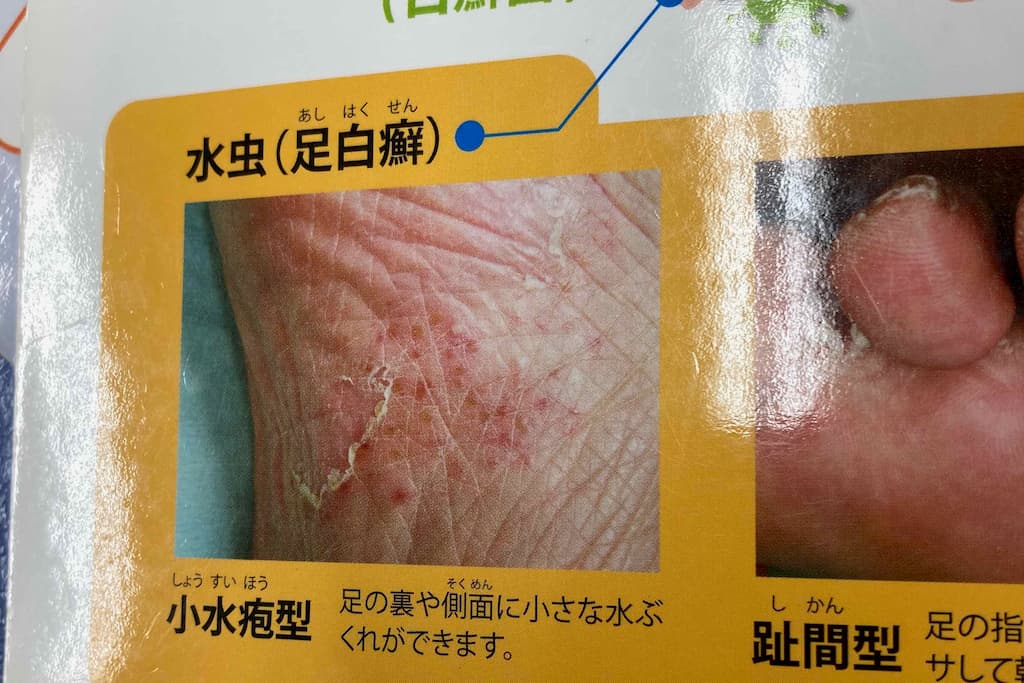 f:id:aremo-koremo:20201220184832j:plain