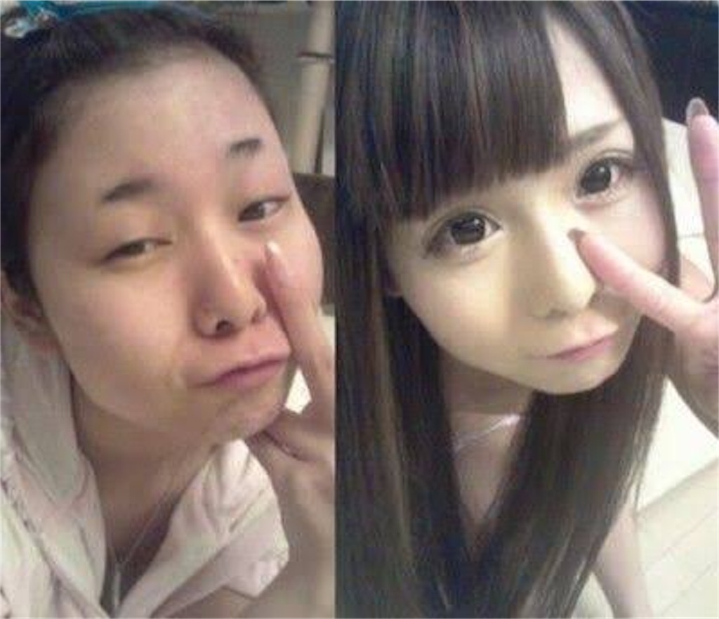 アイプチしてるよね 笑 と言われたことがある代の女子大生必見 3ヶ月で常に不安定な二重幅を安定させて 周りの人から 可愛くなったね と言われる方法