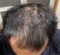 f:id:around-40aga:20210423000210j:plain