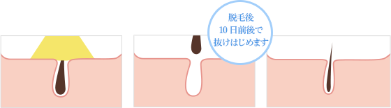 f:id:aroundfour:20180825195223p:plain f:id:aroundfour:20180825195223p:plain