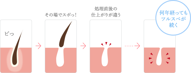 f:id:aroundfour:20180825200427p:plain f:id:aroundfour:20180825200427p:plain
