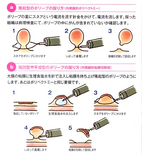 f:id:ason-kohzaki:20200106232630p:plain