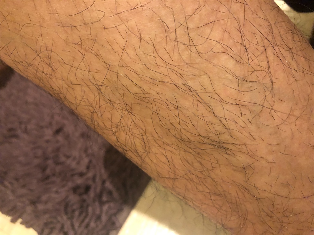 f:id:aspfe:20200327190431j:image f:id:aspfe:20200327190431j:image