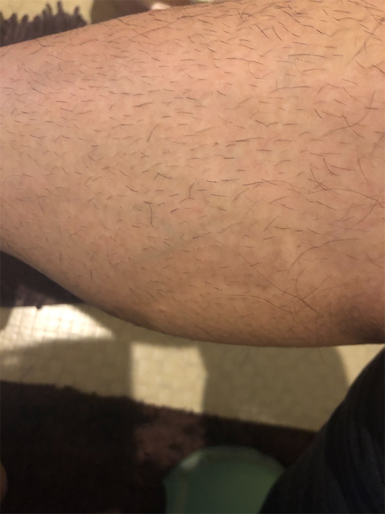 f:id:aspfe:20200327190521j:image f:id:aspfe:20200327190521j:image