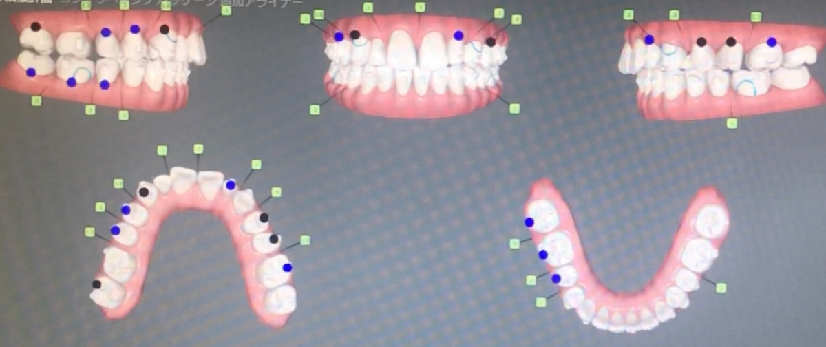 シュミレーション