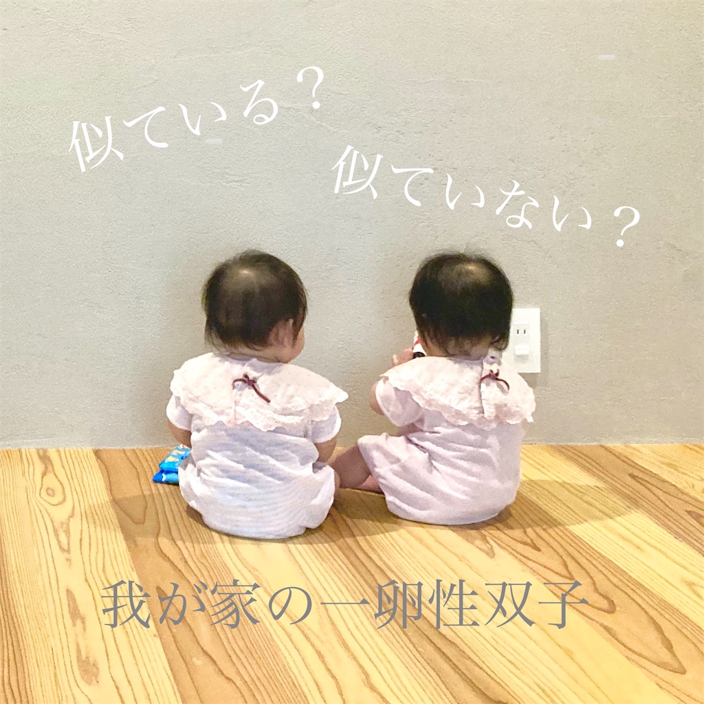 一卵性双子はそっくり？見た目、性格どこまで似ている？