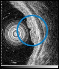 f:id:atsuhiro-me:20151119212253j:plain:w300