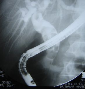 f:id:atsuhiro-me:20151119212255j:plain:w300