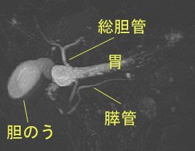 f:id:atsuhiro-me:20151119212300j:plain:w300