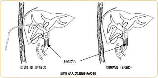 f:id:atsuhiro-me:20151119212301j:plain:w300