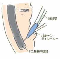 f:id:atsuhiro-me:20151119212302j:plain:w300