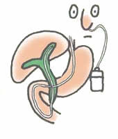 f:id:atsuhiro-me:20151119212303j:plain:w300