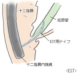 f:id:atsuhiro-me:20151129003743g:plain:w300