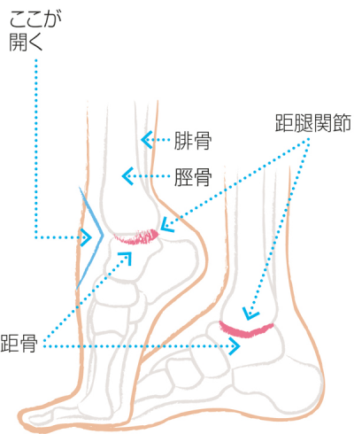 f:id:atsuki800:20210314095445p:plain