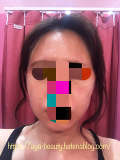 f:id:aya_beauty:20191208224249p:plain