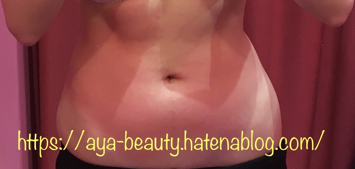 f:id:aya_beauty:20200111194609j:plain