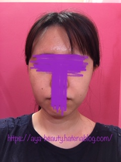 f:id:aya_beauty:20200816200903j:plain f:id:aya_beauty:20200816200903j:plain