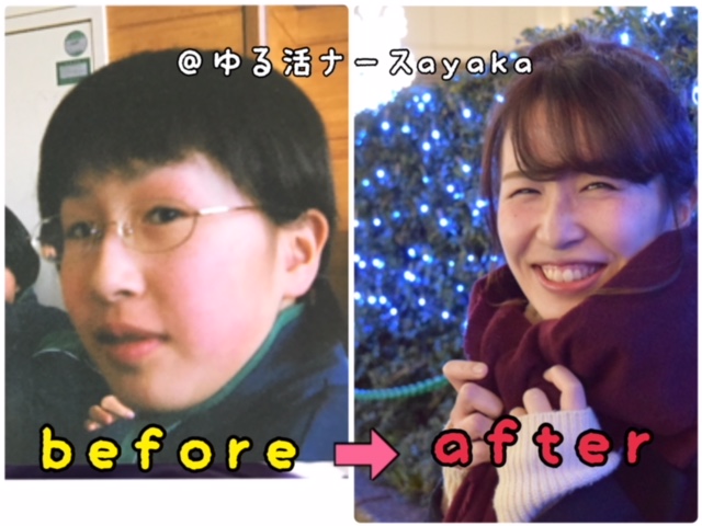 f:id:ayapix:20171201211212j:plain f:id:ayapix:20171201211212j:plain