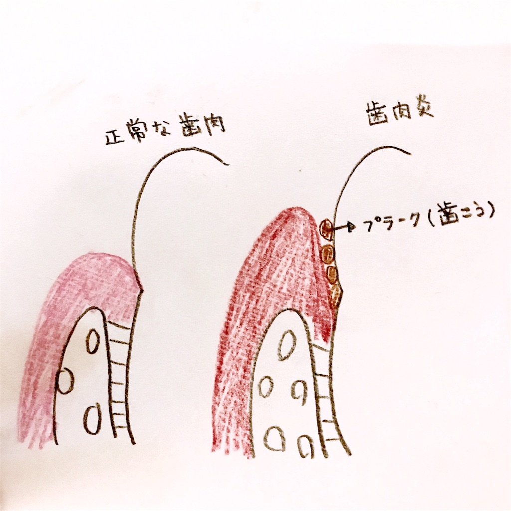 f:id:ayuchanhonpo1105:20170823220511j:image