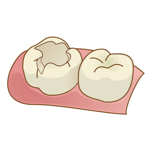 f:id:ayuchanhonpo1105:20170906233529p:plain