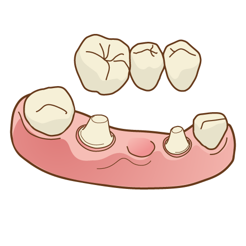 f:id:ayuchanhonpo1105:20171003223349p:plain f:id:ayuchanhonpo1105:20171003223349p:plain