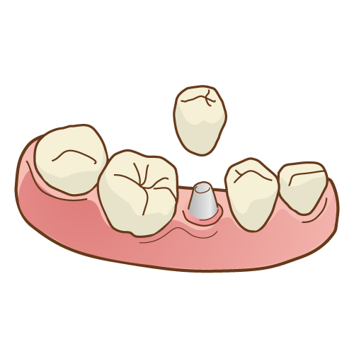 f:id:ayuchanhonpo1105:20171003223424p:plain