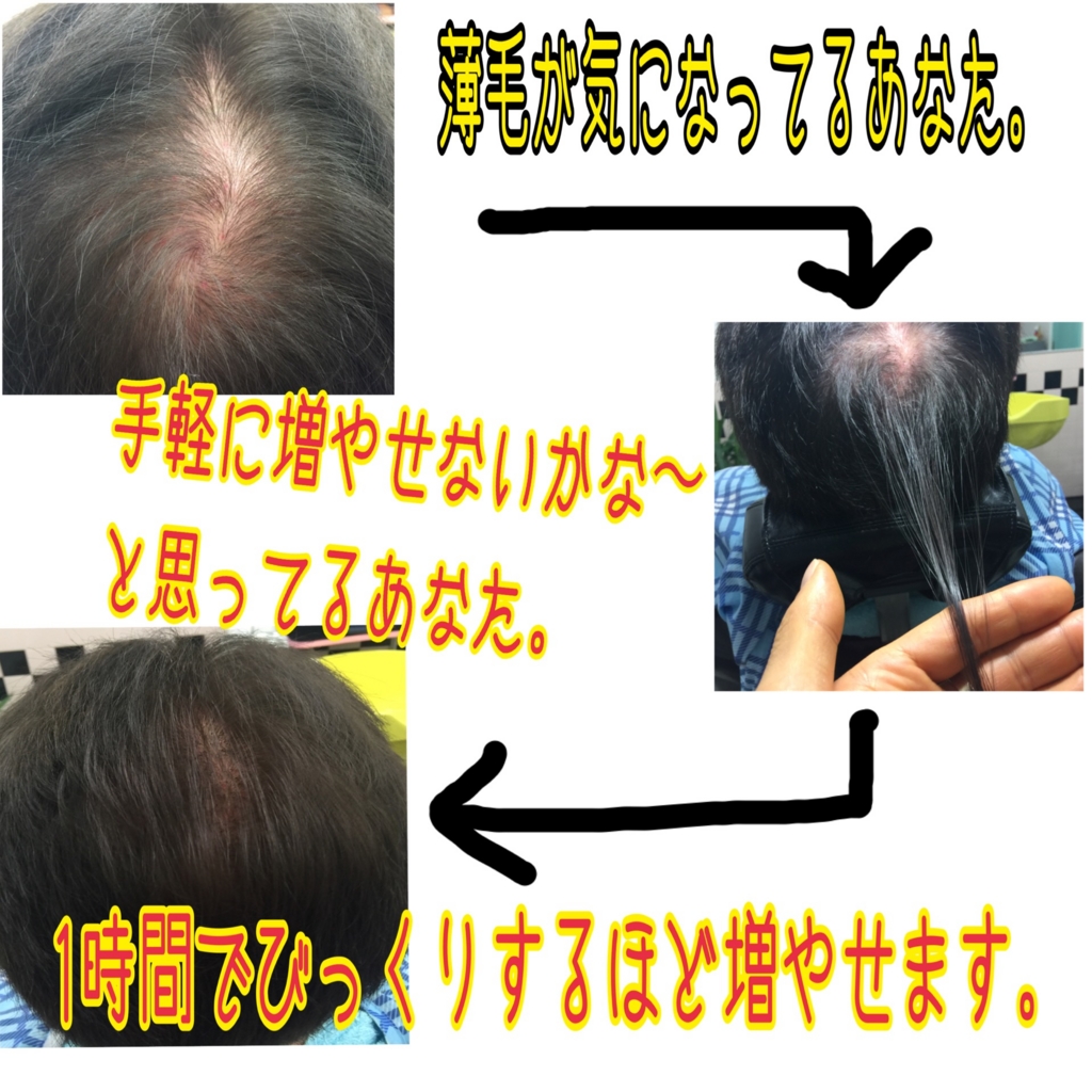 f:id:ayuturi40:20160802183803j:plain