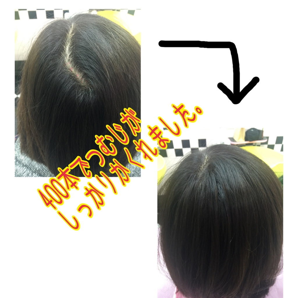 f:id:ayuturi40:20161211163836j:plain