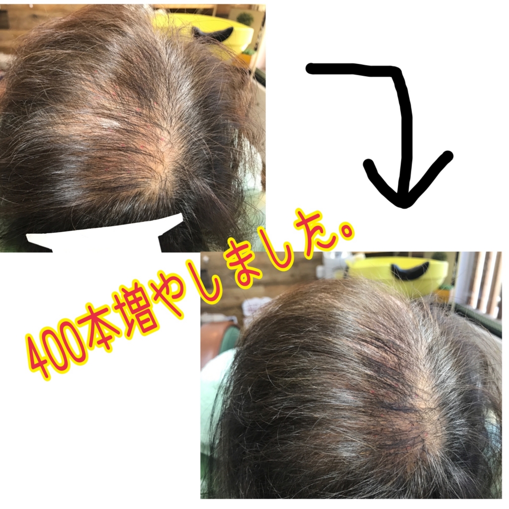 f:id:ayuturi40:20161221174802j:plain f:id:ayuturi40:20161221174802j:plain