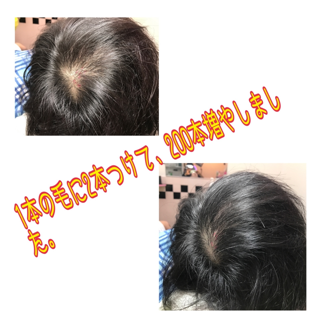 f:id:ayuturi40:20170110193629j:plain f:id:ayuturi40:20170110193629j:plain