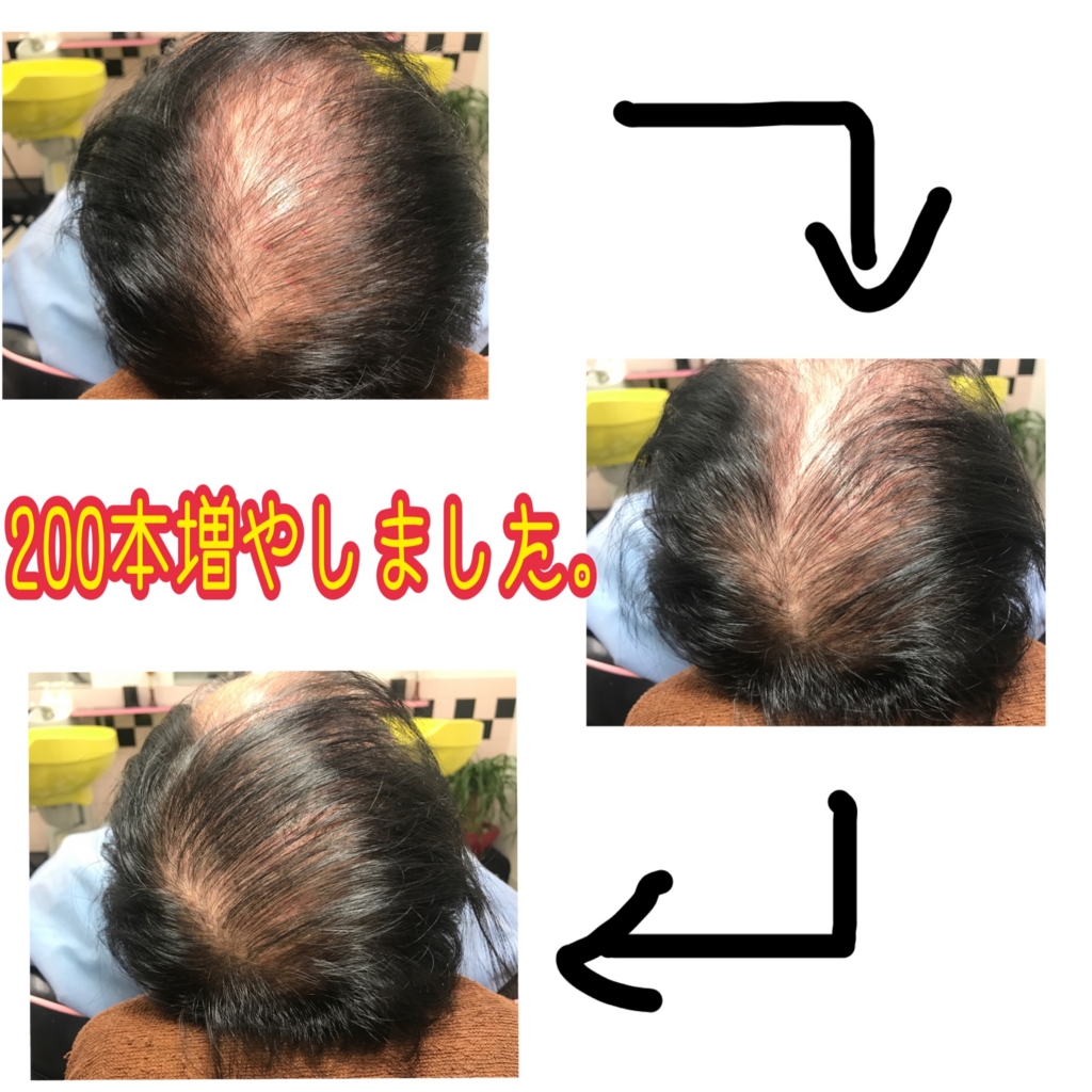 f:id:ayuturi40:20170110193720j:plain f:id:ayuturi40:20170110193720j:plain