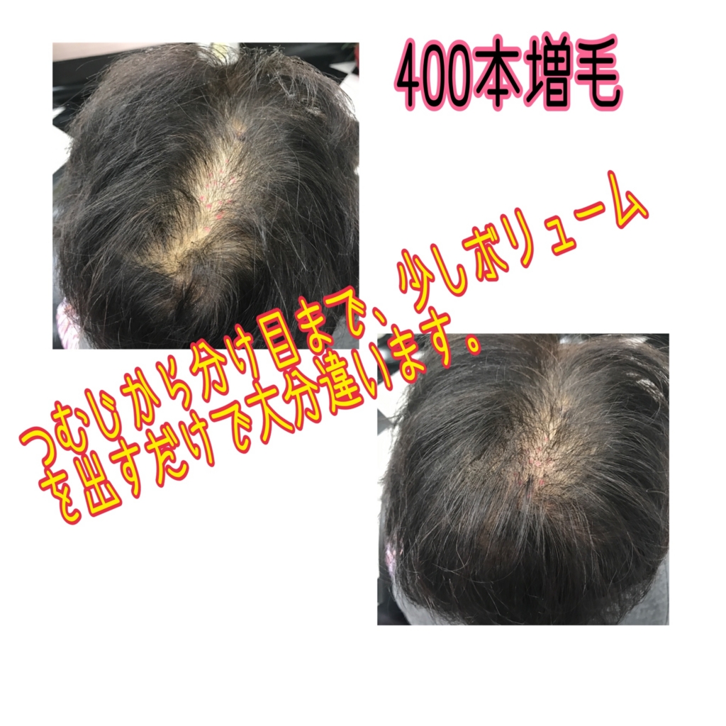 f:id:ayuturi40:20170128180109j:plain f:id:ayuturi40:20170128180109j:plain