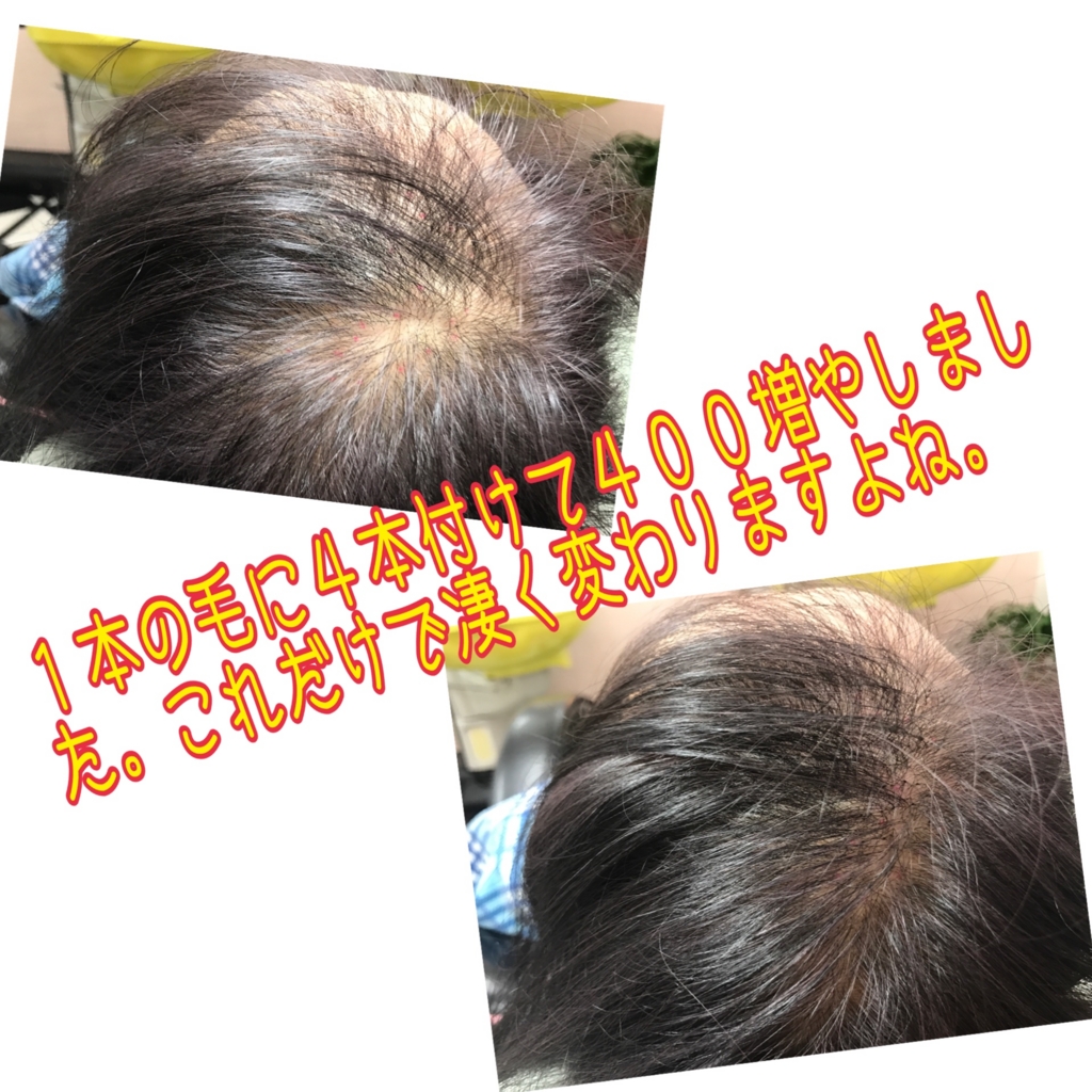 f:id:ayuturi40:20170210102919j:plain