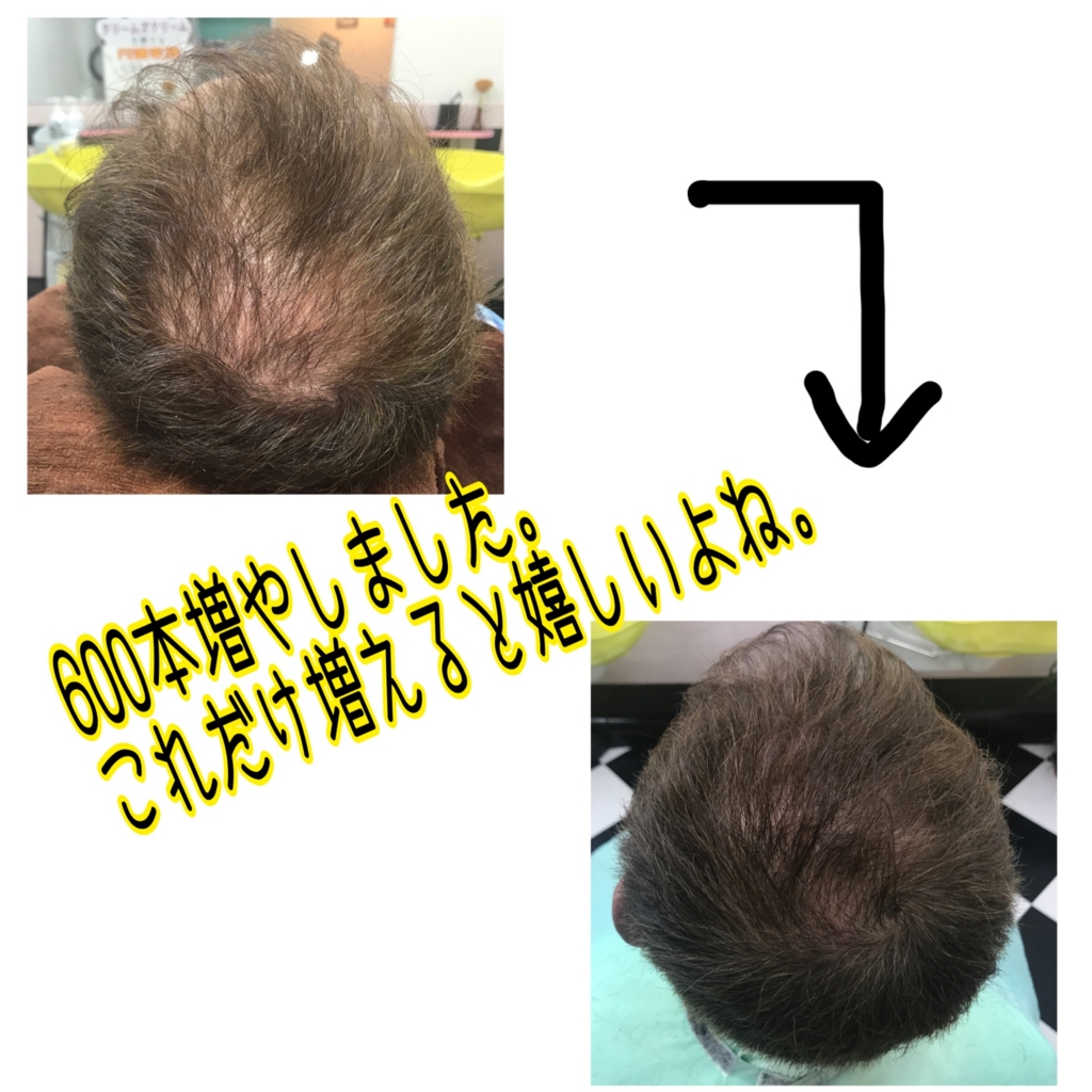f:id:ayuturi40:20170315114655j:plain f:id:ayuturi40:20170315114655j:plain
