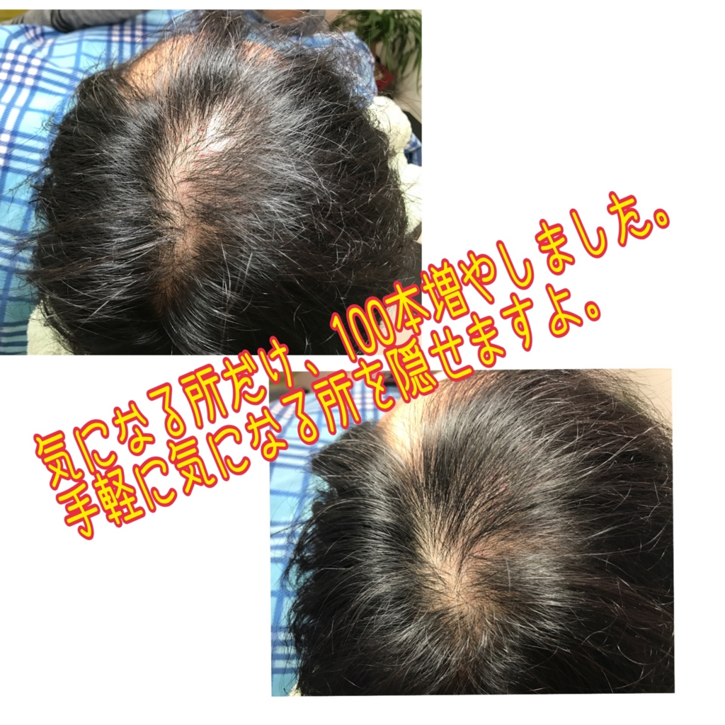 f:id:ayuturi40:20170315115101j:plain f:id:ayuturi40:20170315115101j:plain