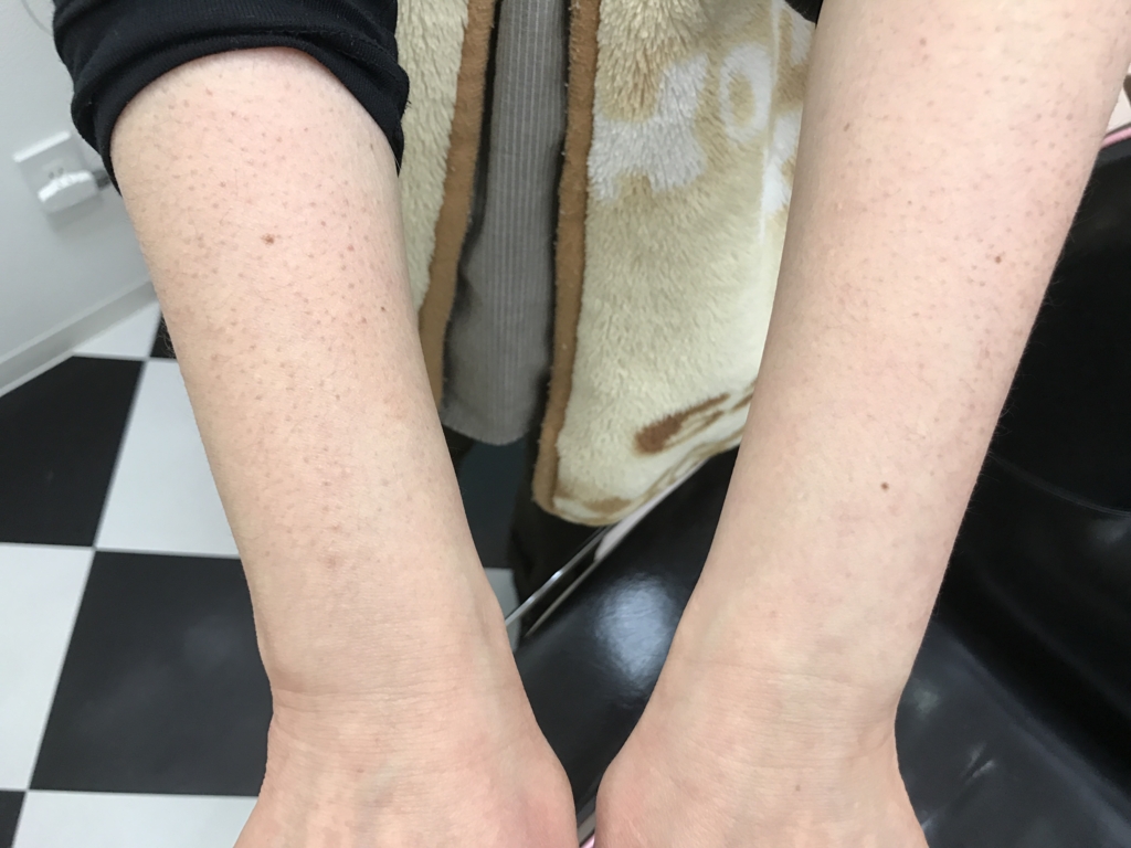 f:id:ayuturi40:20170329130831j:plain