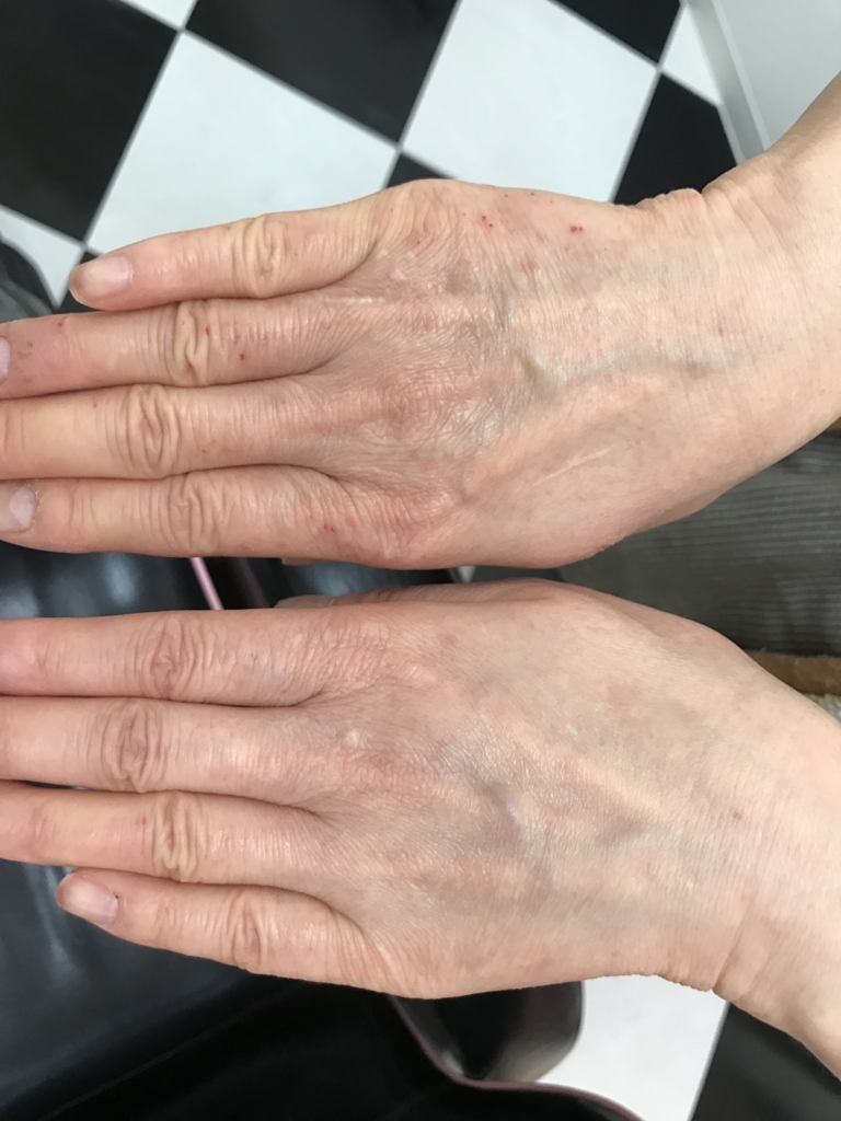 f:id:ayuturi40:20170329132039j:plain