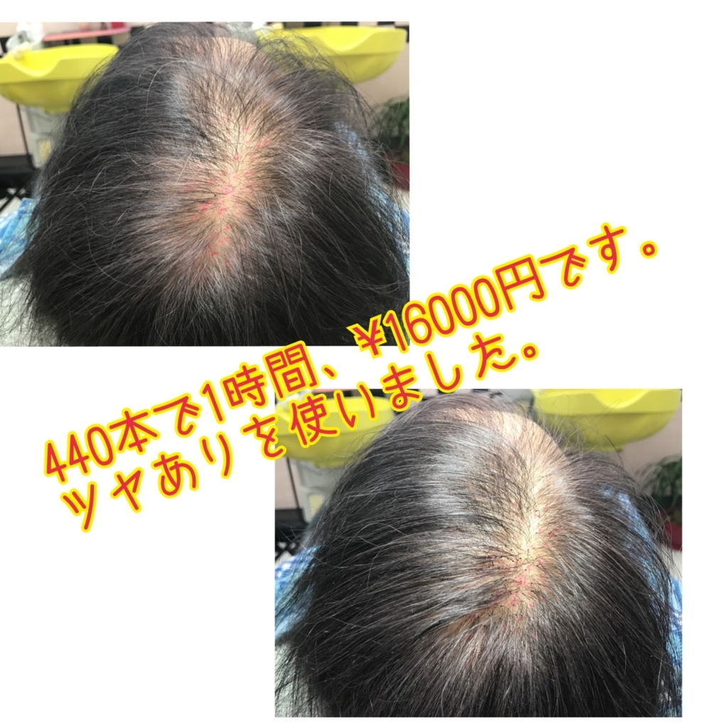 f:id:ayuturi40:20170803135750j:plain f:id:ayuturi40:20170803135750j:plain