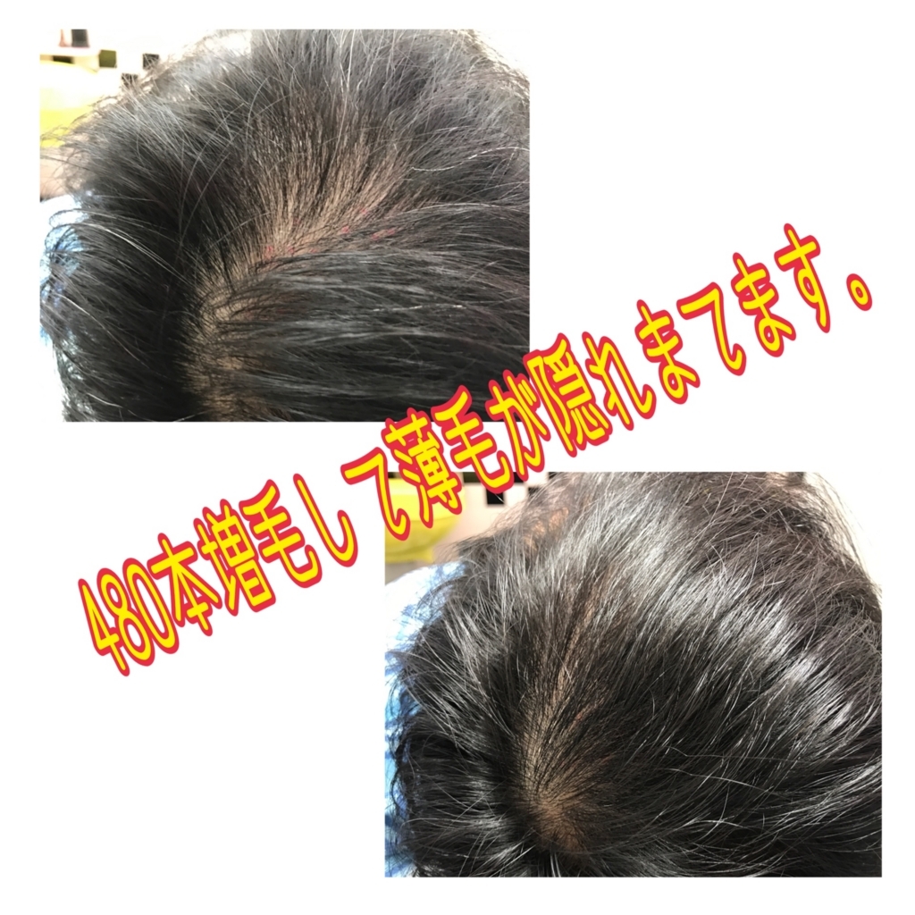 f:id:ayuturi40:20170830133457j:plain