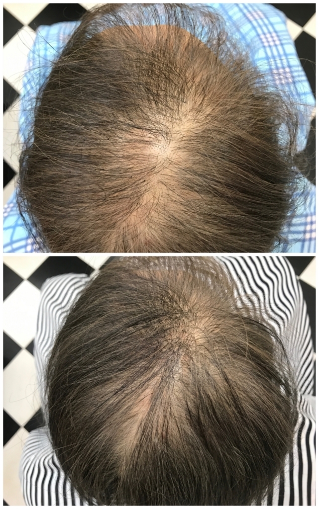 f:id:ayuturi40:20171025144039j:plain f:id:ayuturi40:20171025144039j:plain