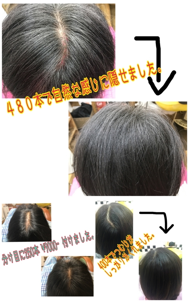 f:id:ayuturi40:20171025144115j:plain