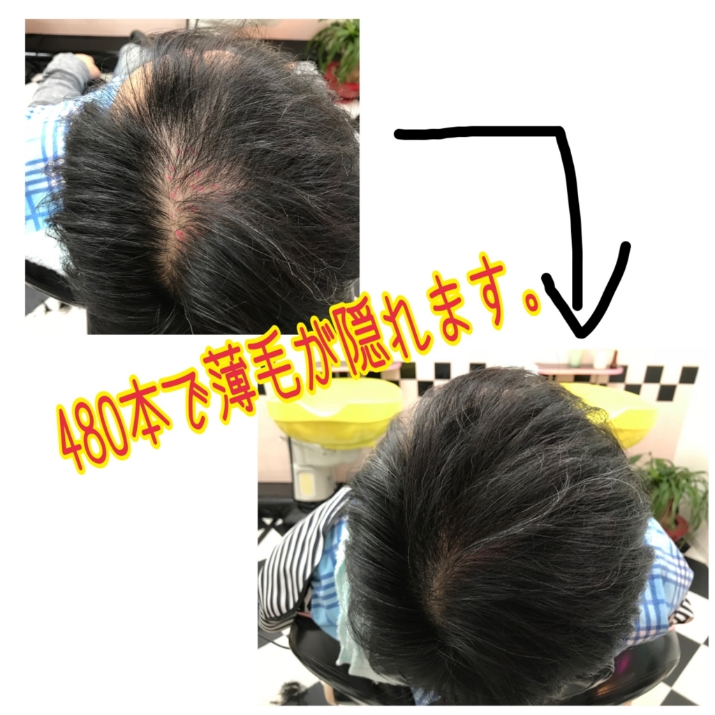 f:id:ayuturi40:20171205131332j:plain f:id:ayuturi40:20171205131332j:plain